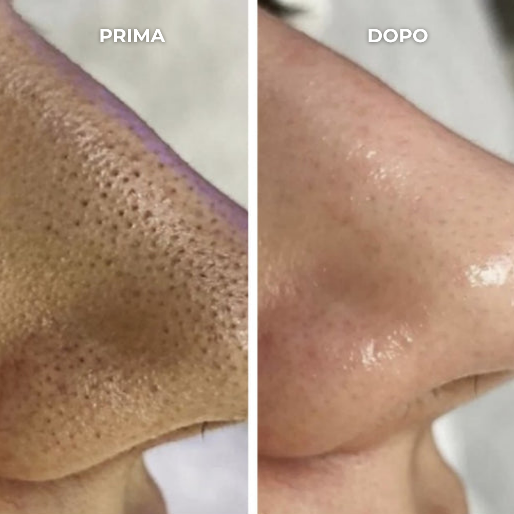 SEOYA – Scrub al riso coreano 30 ml